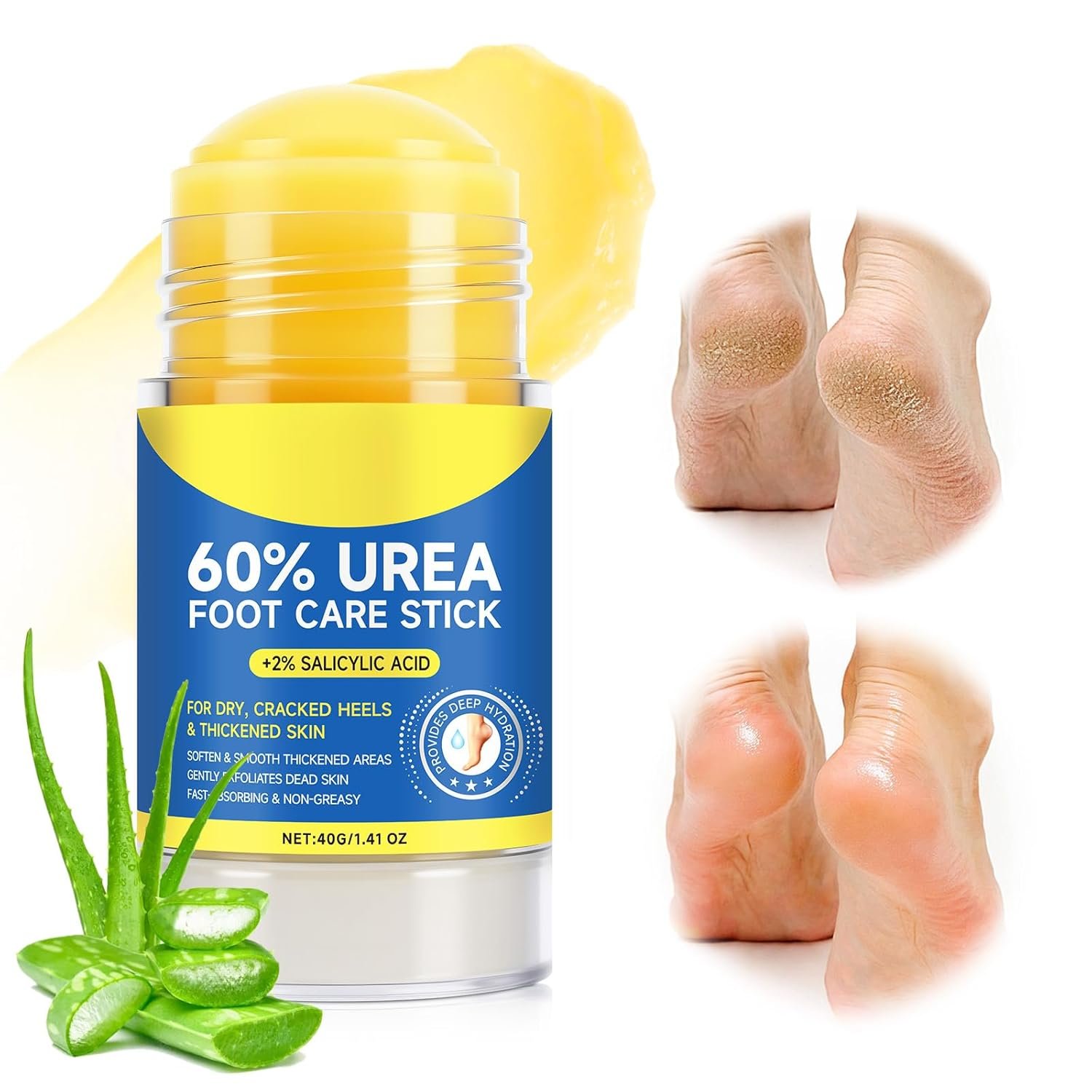 60% Urea Cream Stick with 2% Salicylic Acid, Maximum Strength Foot Cream Stick for Dry Cracked Heels & Calluses, Rapidly Softens Thick Skin – Non-Greasy & Fast Acting – 2-Day Visible Results