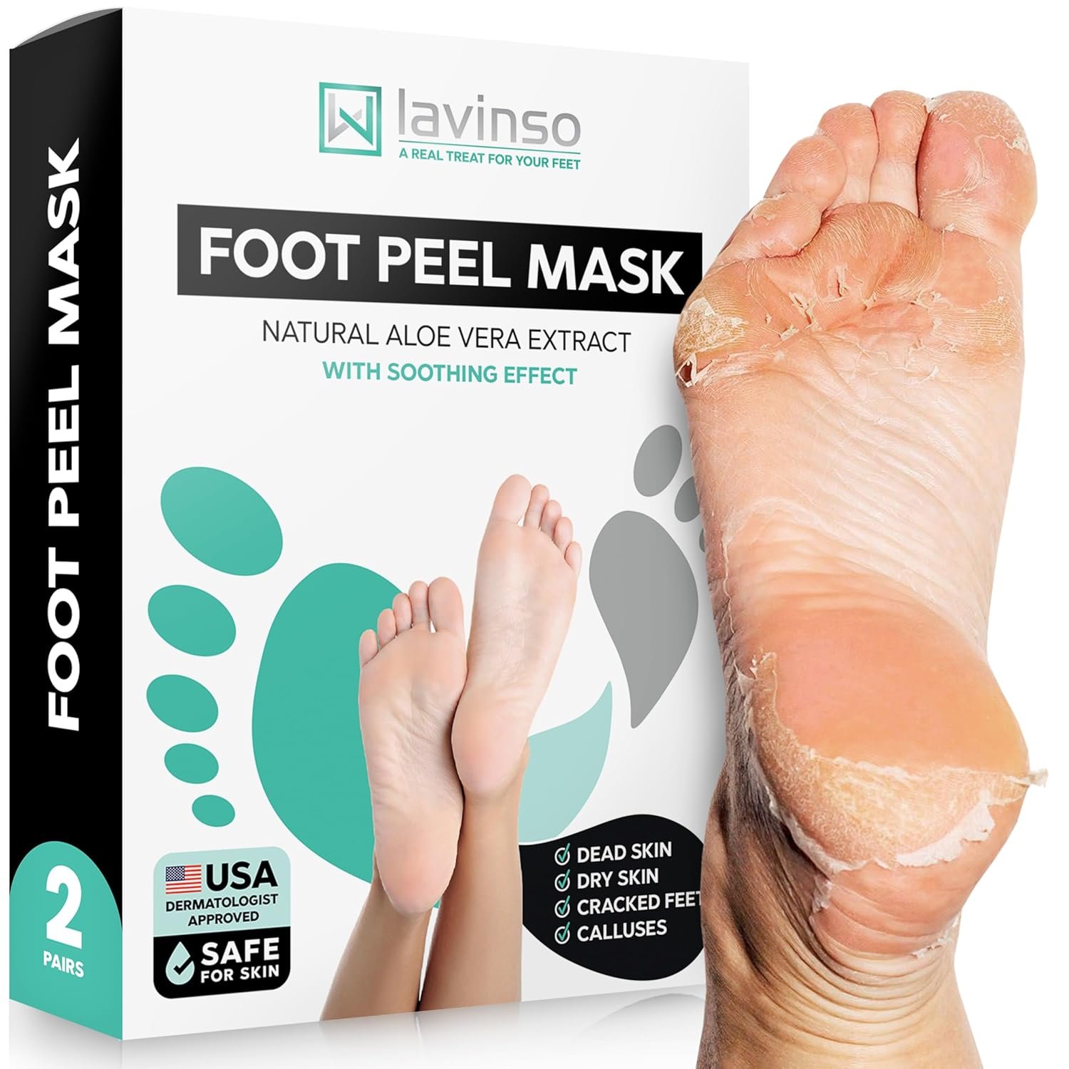 Lavinso Foot Peel Mask for Dry Cracked Feet – 2 Pack Peeling Mask Removes Dead Skin and Calluses – Exfoliating for Soft Baby Feet, Original Scent